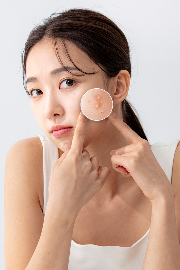 트러블 고민러 사이에서 입소문 난
효과적인 트러블 케어템! 대표 이미지