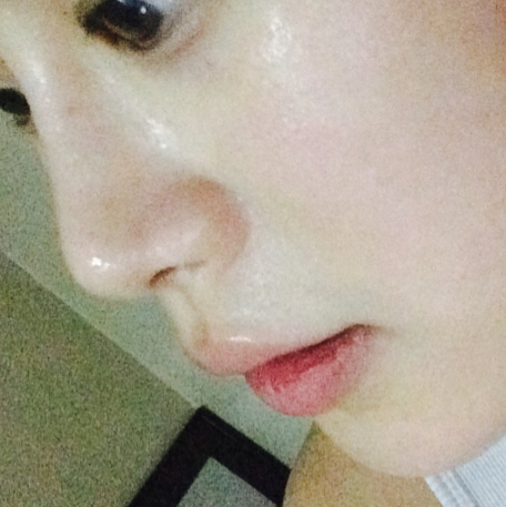아기피부임 프로필