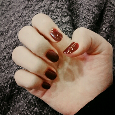 impig 프로필