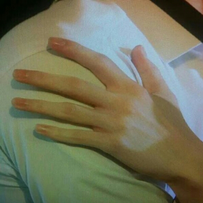 콜베라잇 프로필