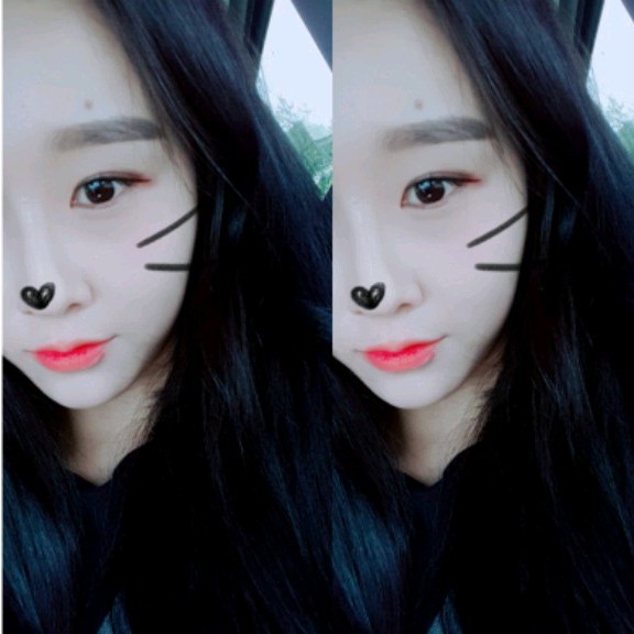 성형만20 프로필