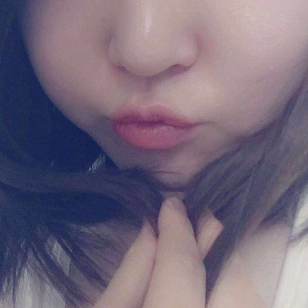 비니알로 프로필