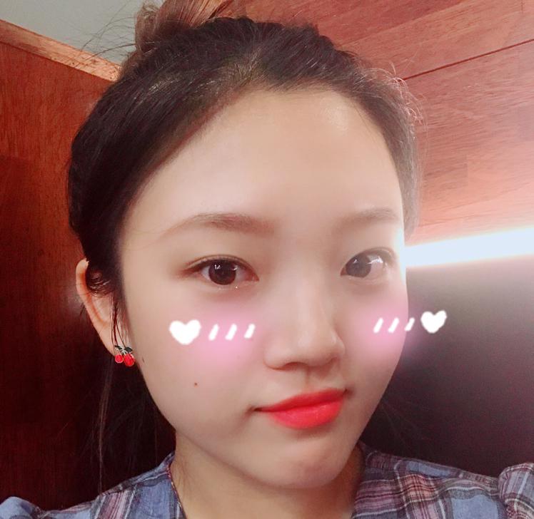 tp 프로필