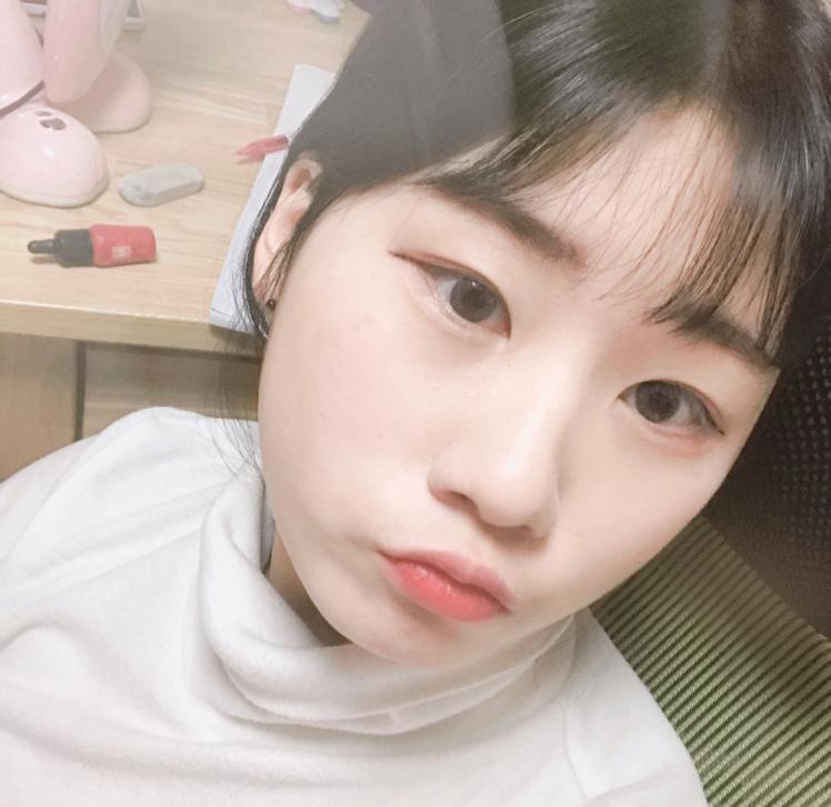앞니 프로필