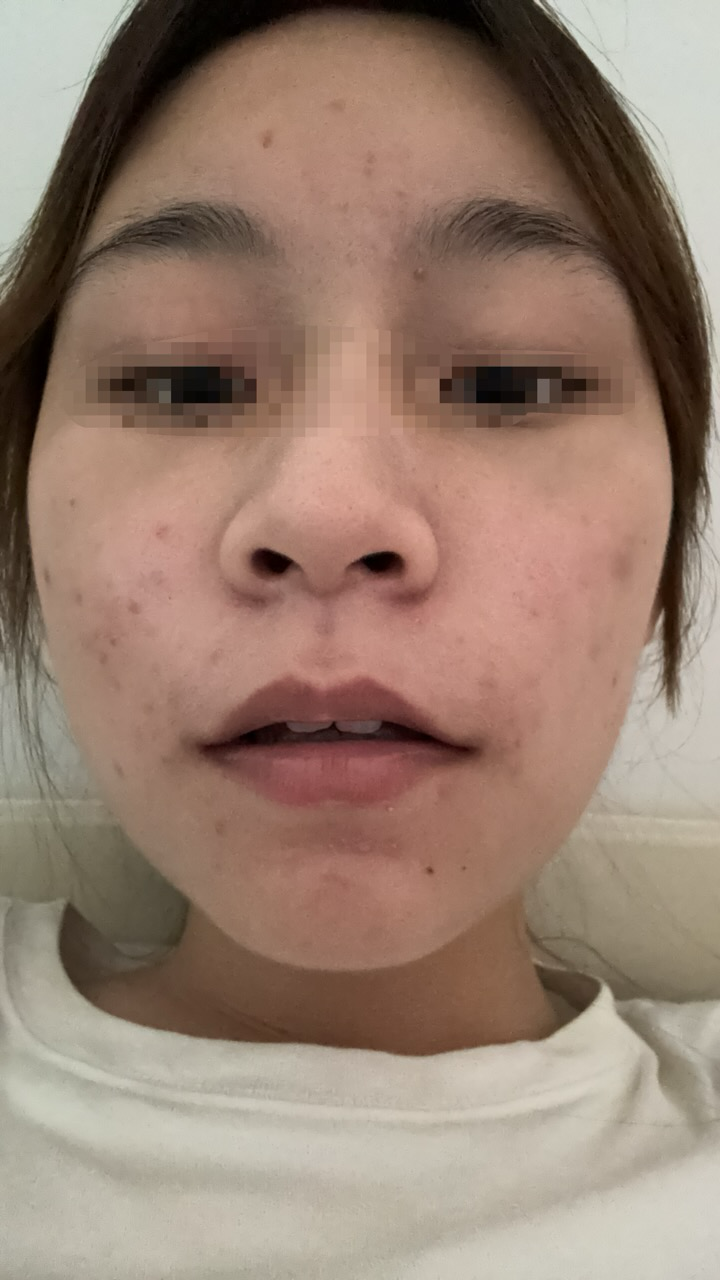 undefined 이미지 1