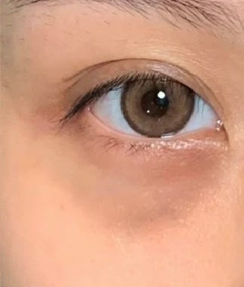 undefined 이미지 1