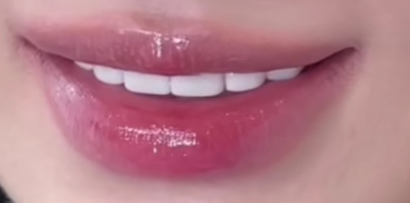 undefined 이미지 1