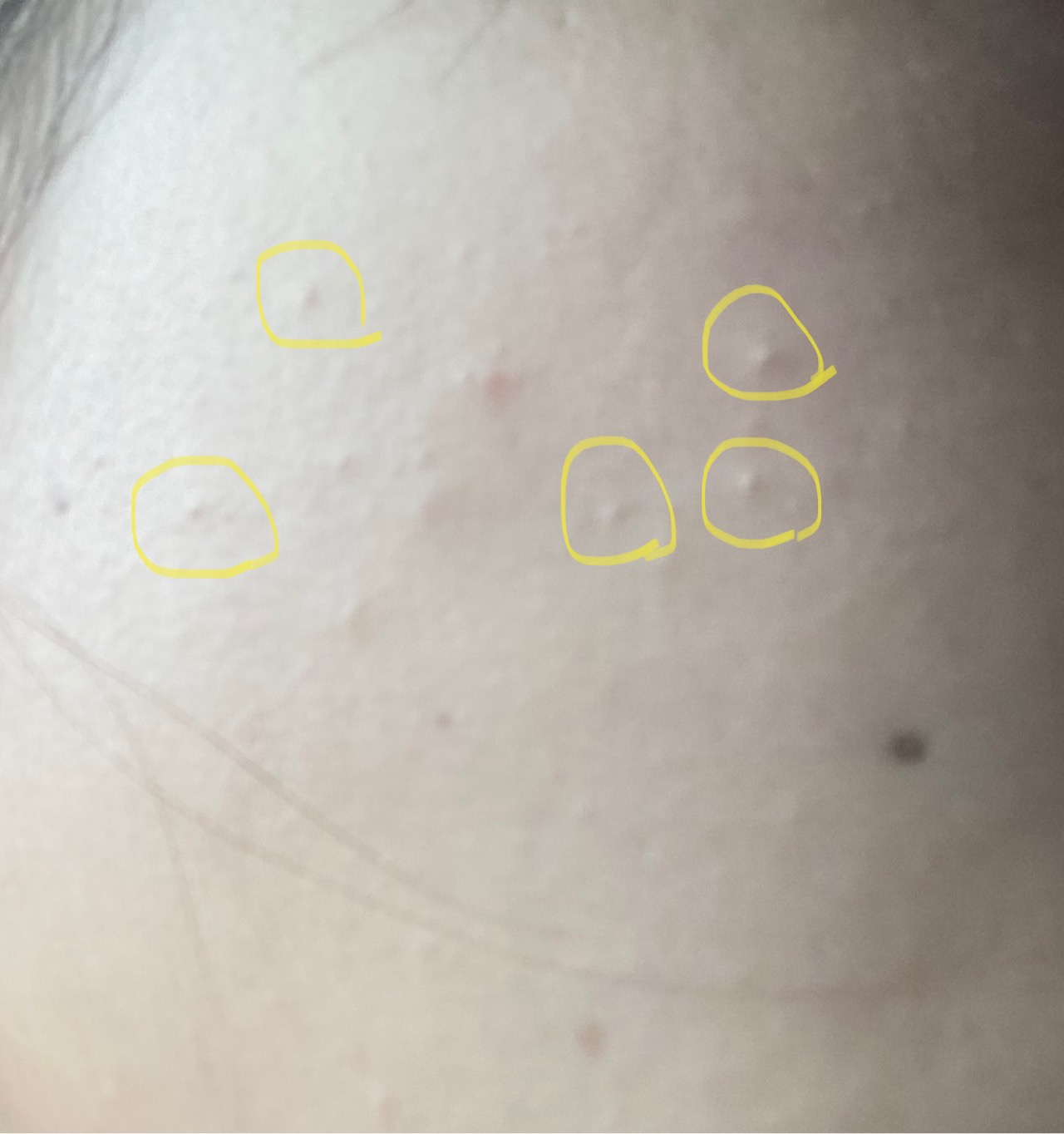 undefined 이미지 1