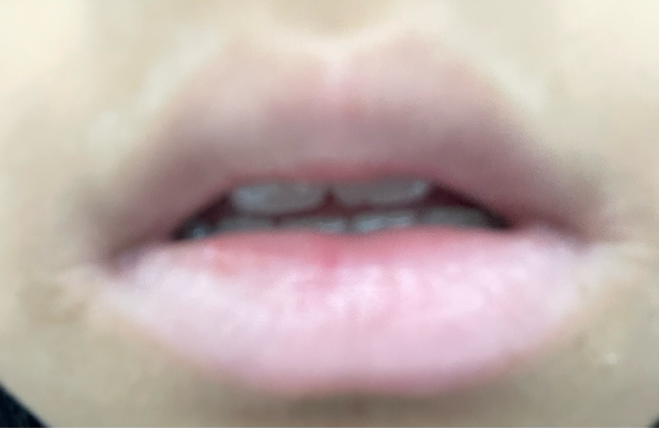 undefined 이미지 1