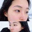 힌슈