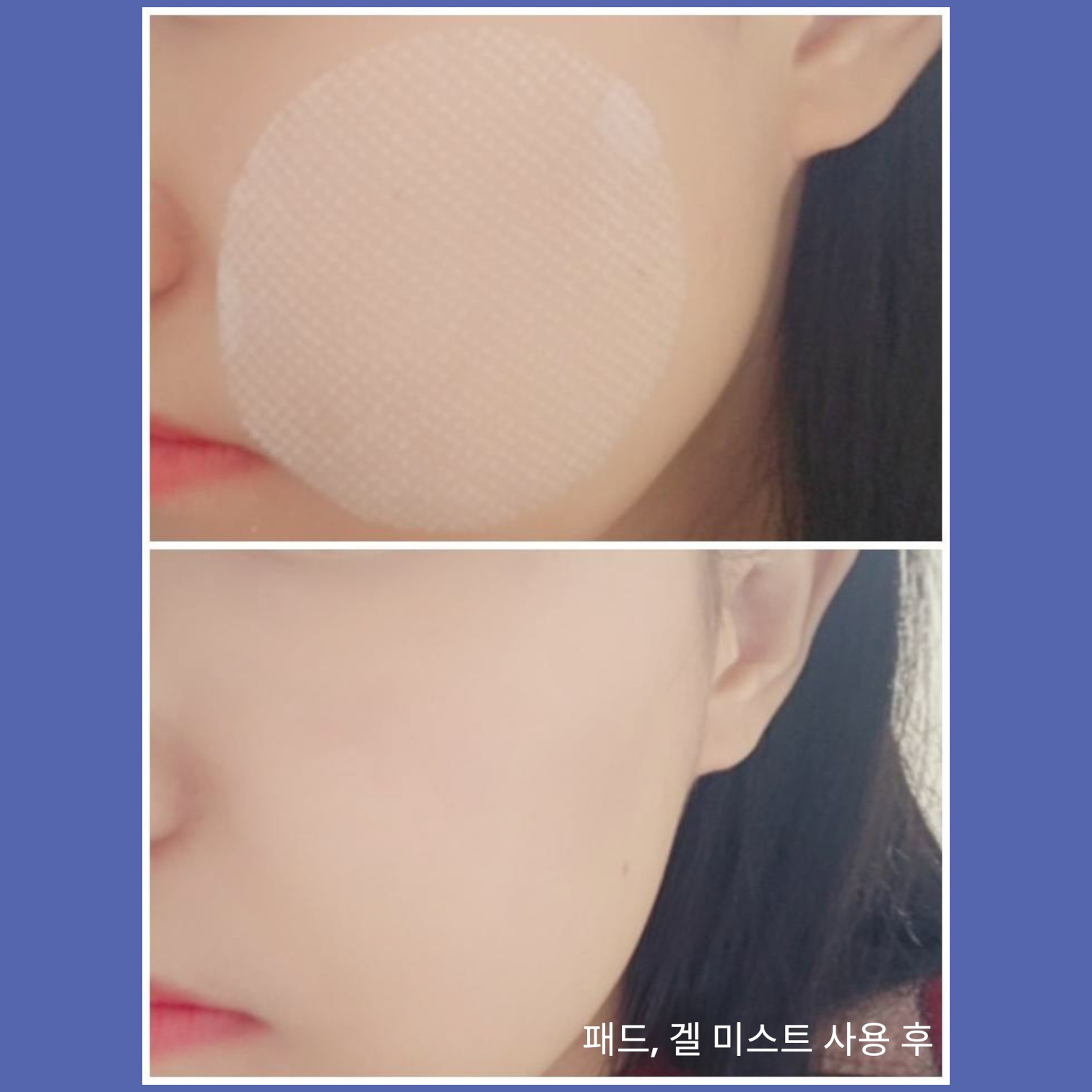 블루 알로에 카밍 포어 패드 이미지 5