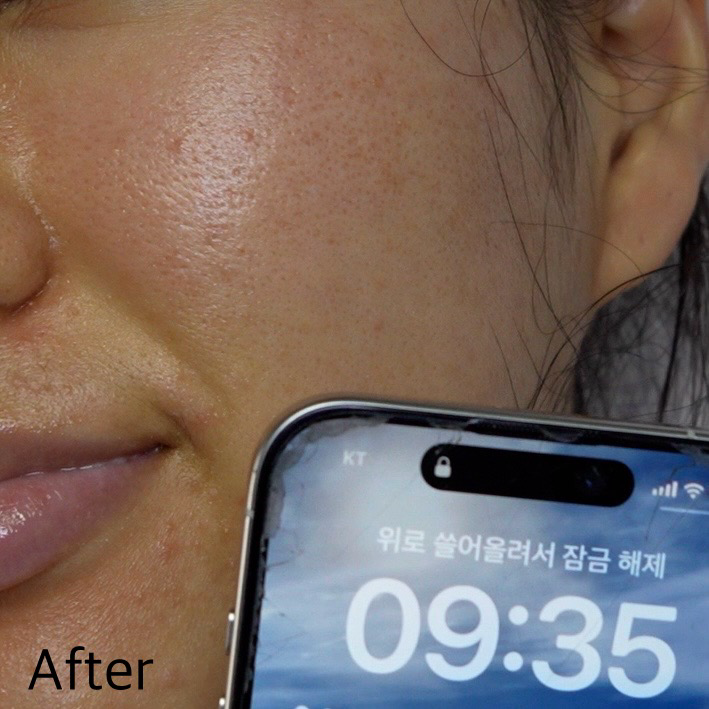 마다가스카르 센텔라 히알루 시카 슬리핑 팩 이미지 2