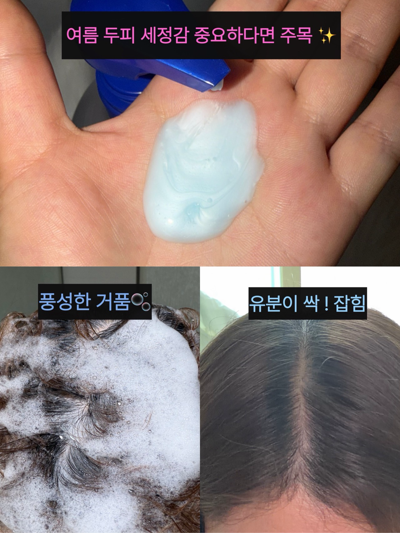 가려운 두피 케어 샴푸 이미지 2