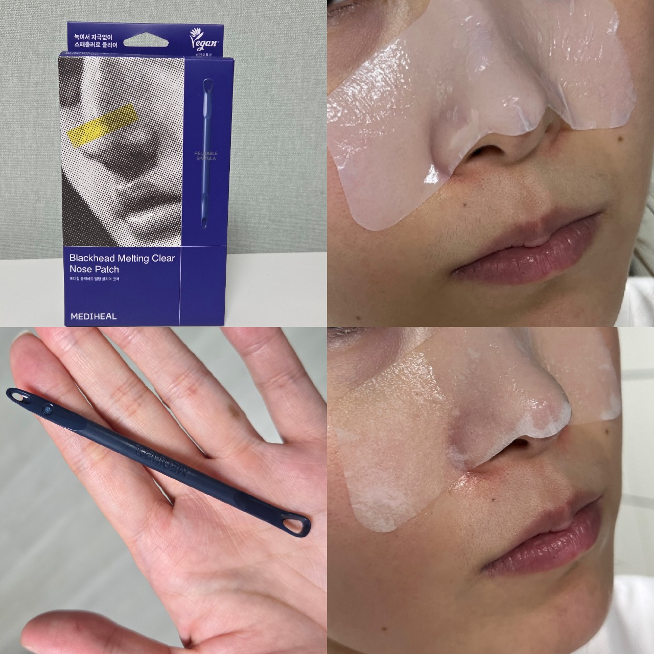 블랙헤드 멜팅 클리어 코팩 이미지 1