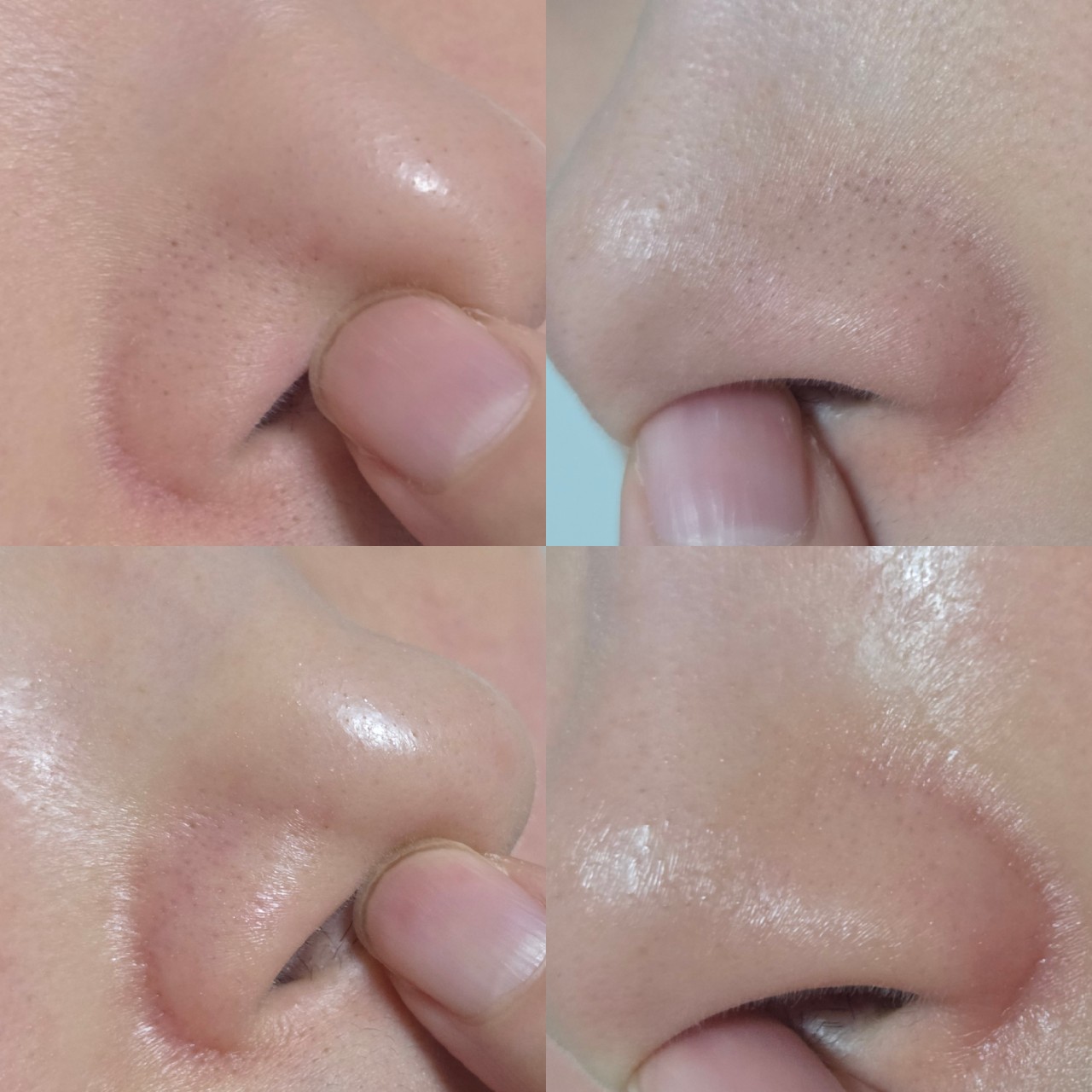 블랙헤드 멜팅 클리어 코팩 이미지 2