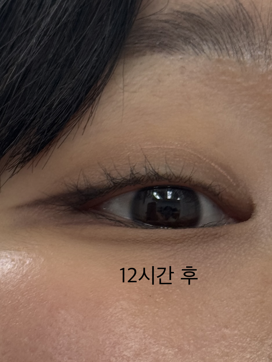올 데이 아이 프렙 픽서 이미지 1