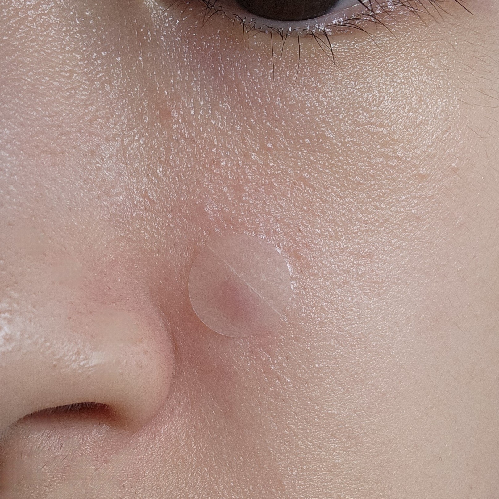 마데카 메디패치 아크큐 이미지 4