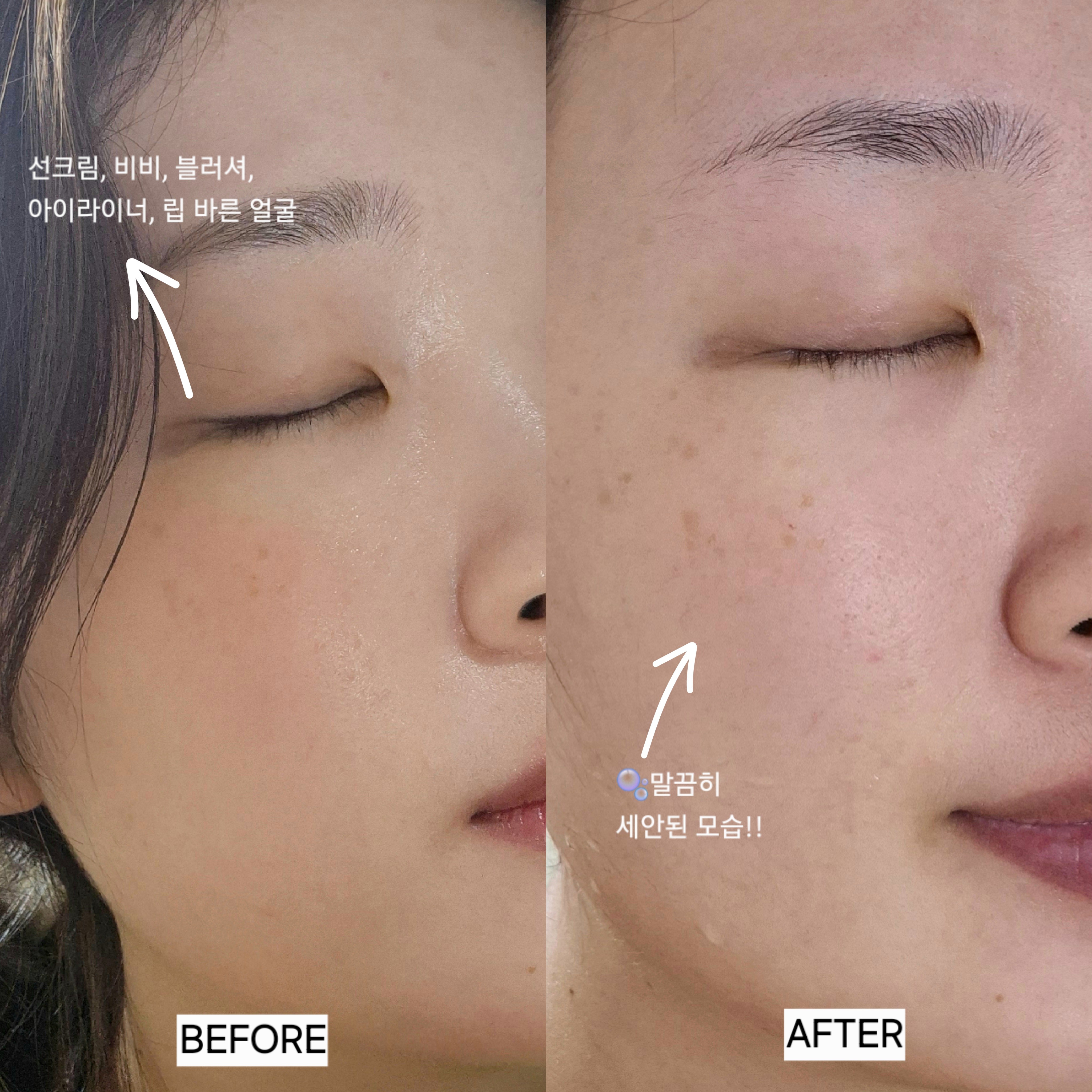 티트리 피지 쏙 젤 클렌징 오일 이미지 2