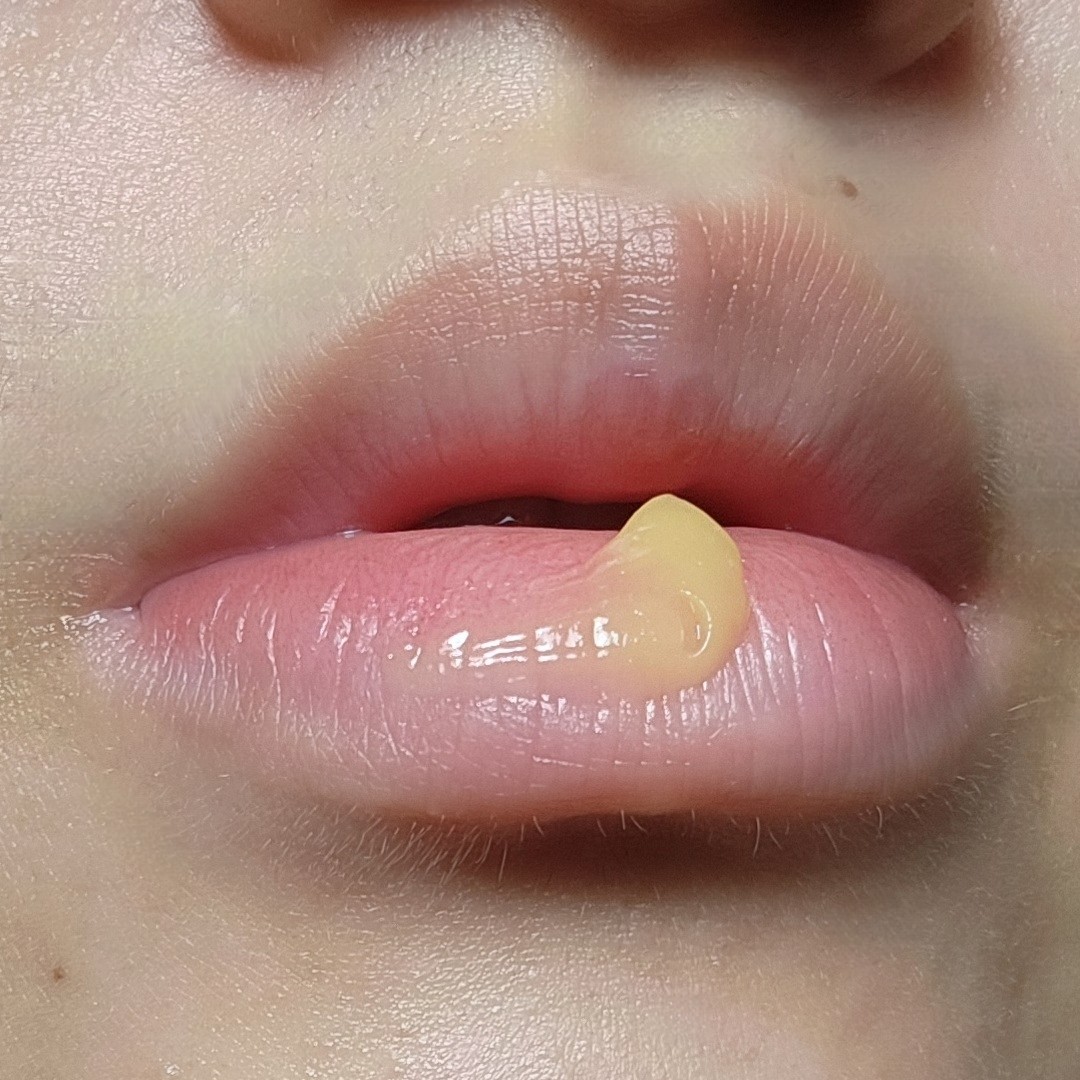 립 글로이 밤 이미지 2