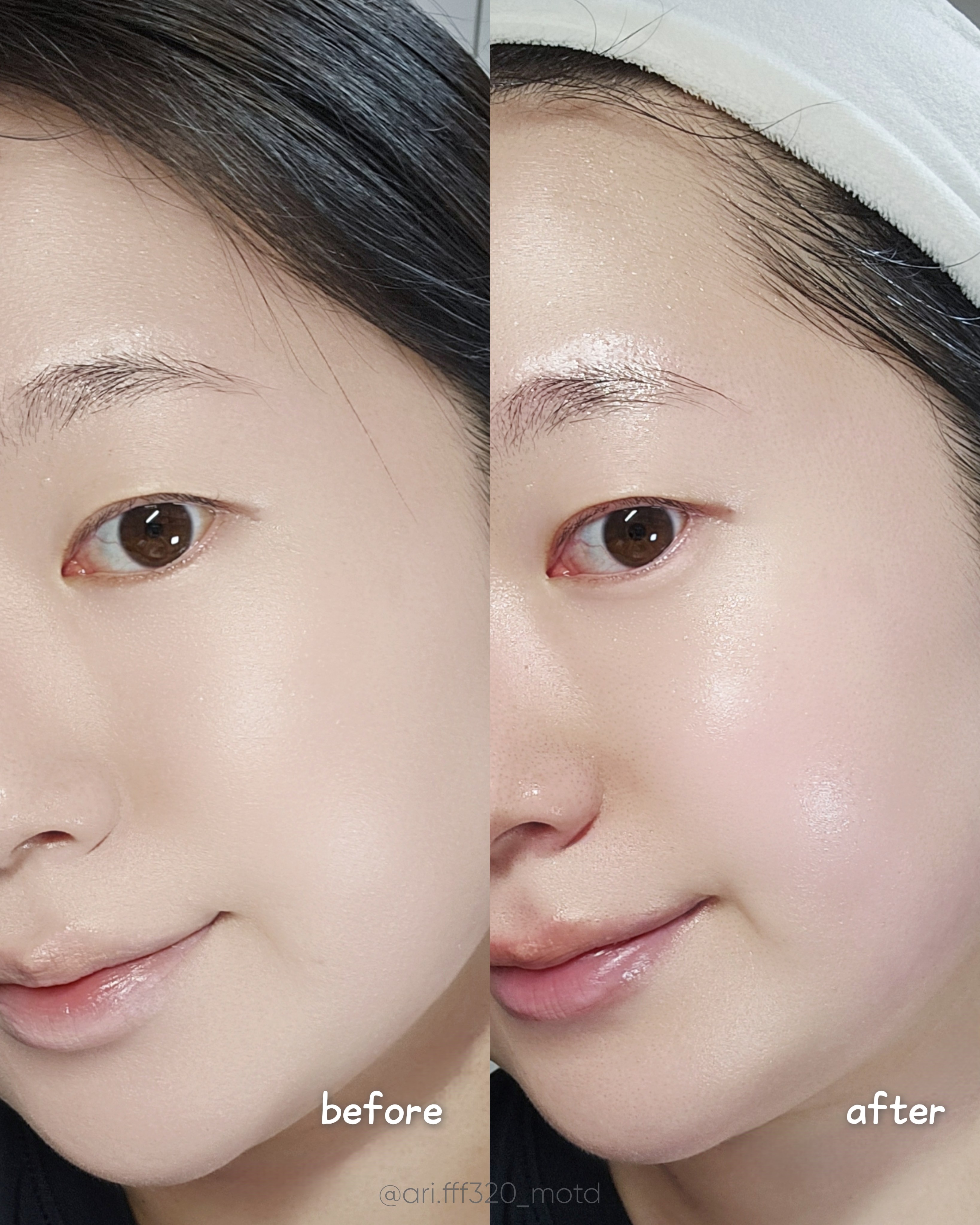 수분 장벽 팡 히알루론산 판테놀 앰플 이미지 3