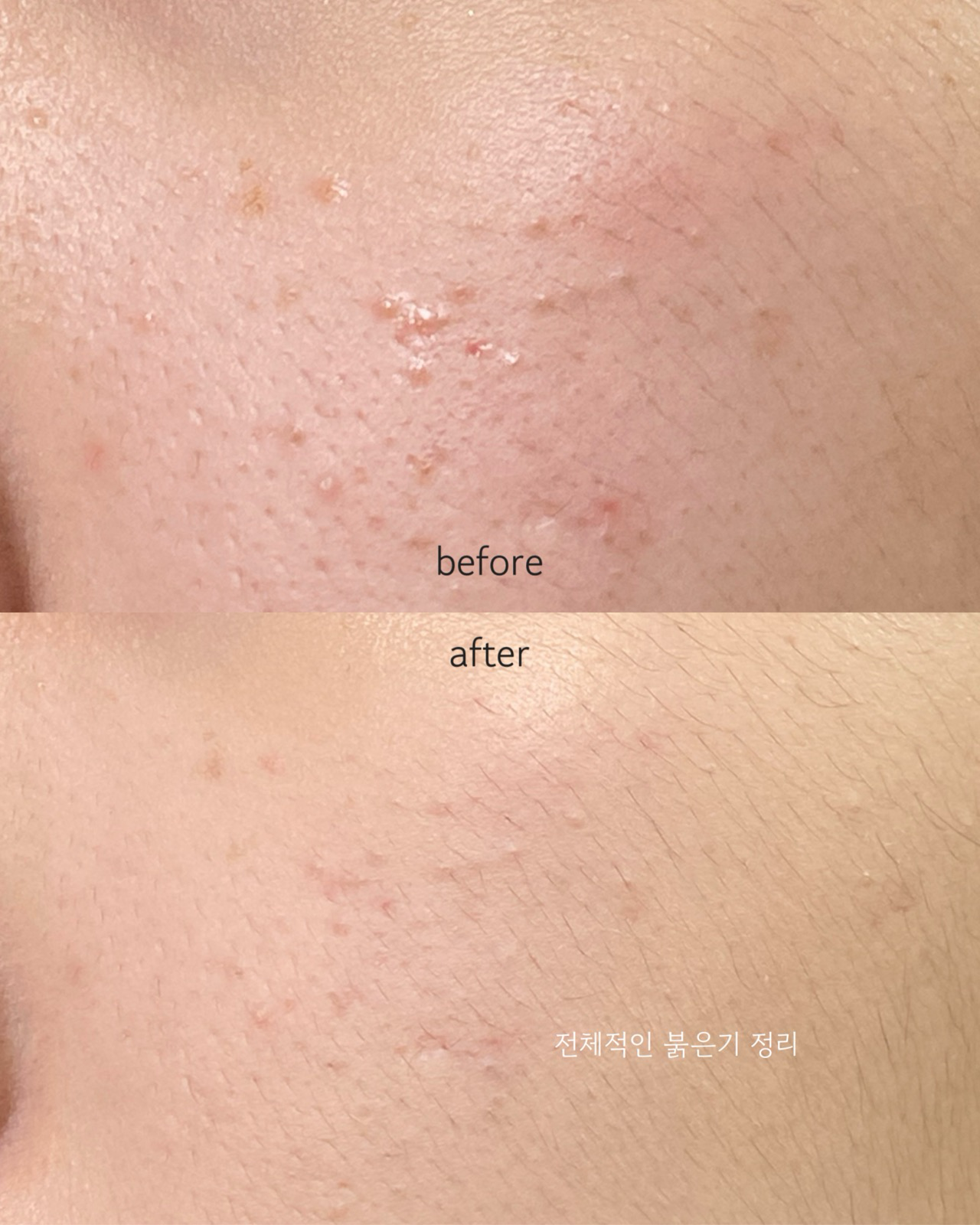 플러핏 라이트매트 쿠션 [SPF50+/PA+++] 이미지 2
