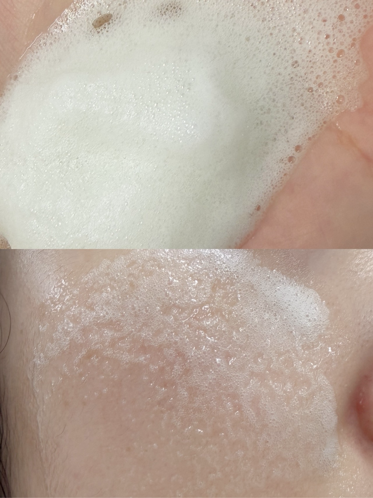 쑥판텐 인텐시브 리페어 수분 드레싱 진정 버블 세럼 이미지 5