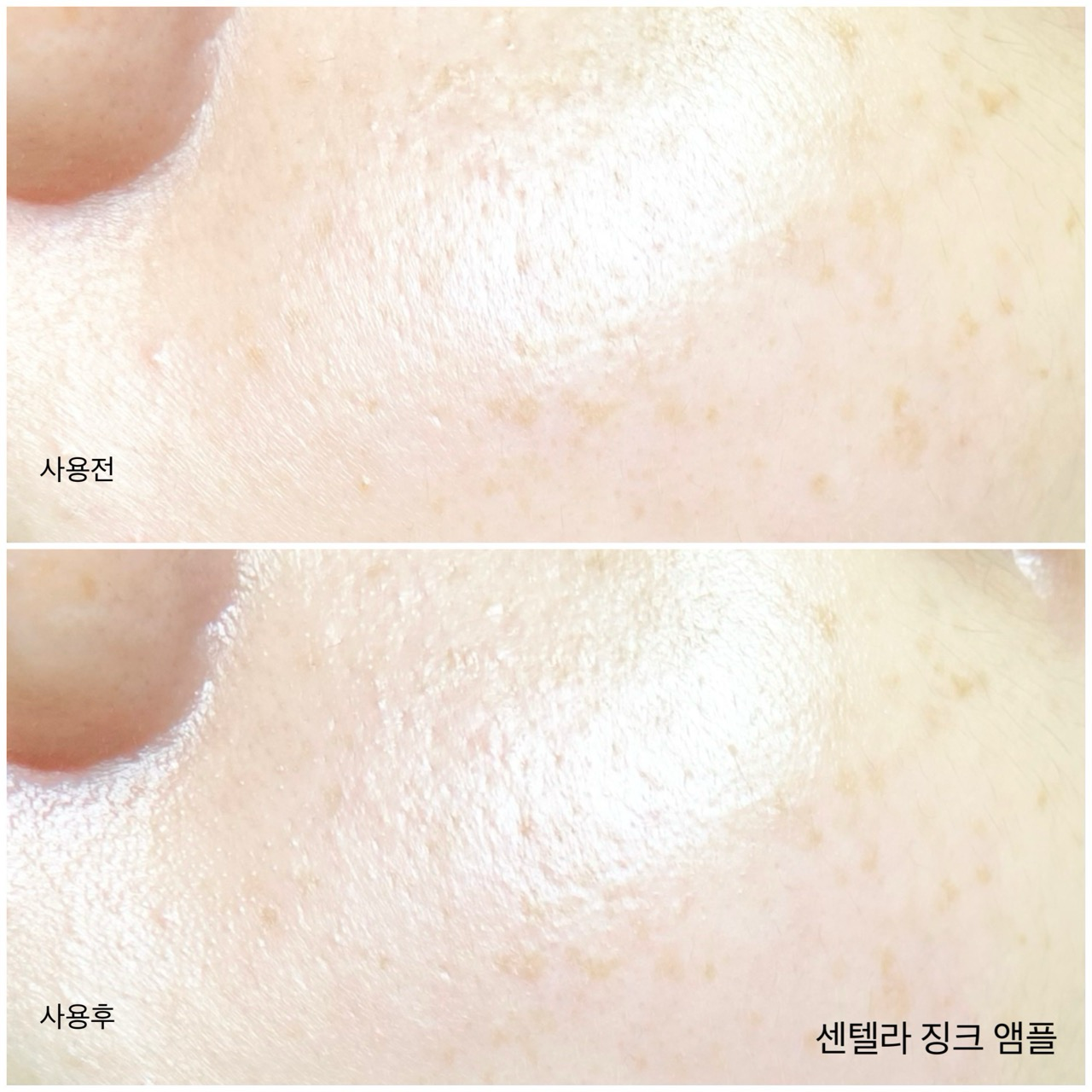센텔라 징크 앰플 이미지 4