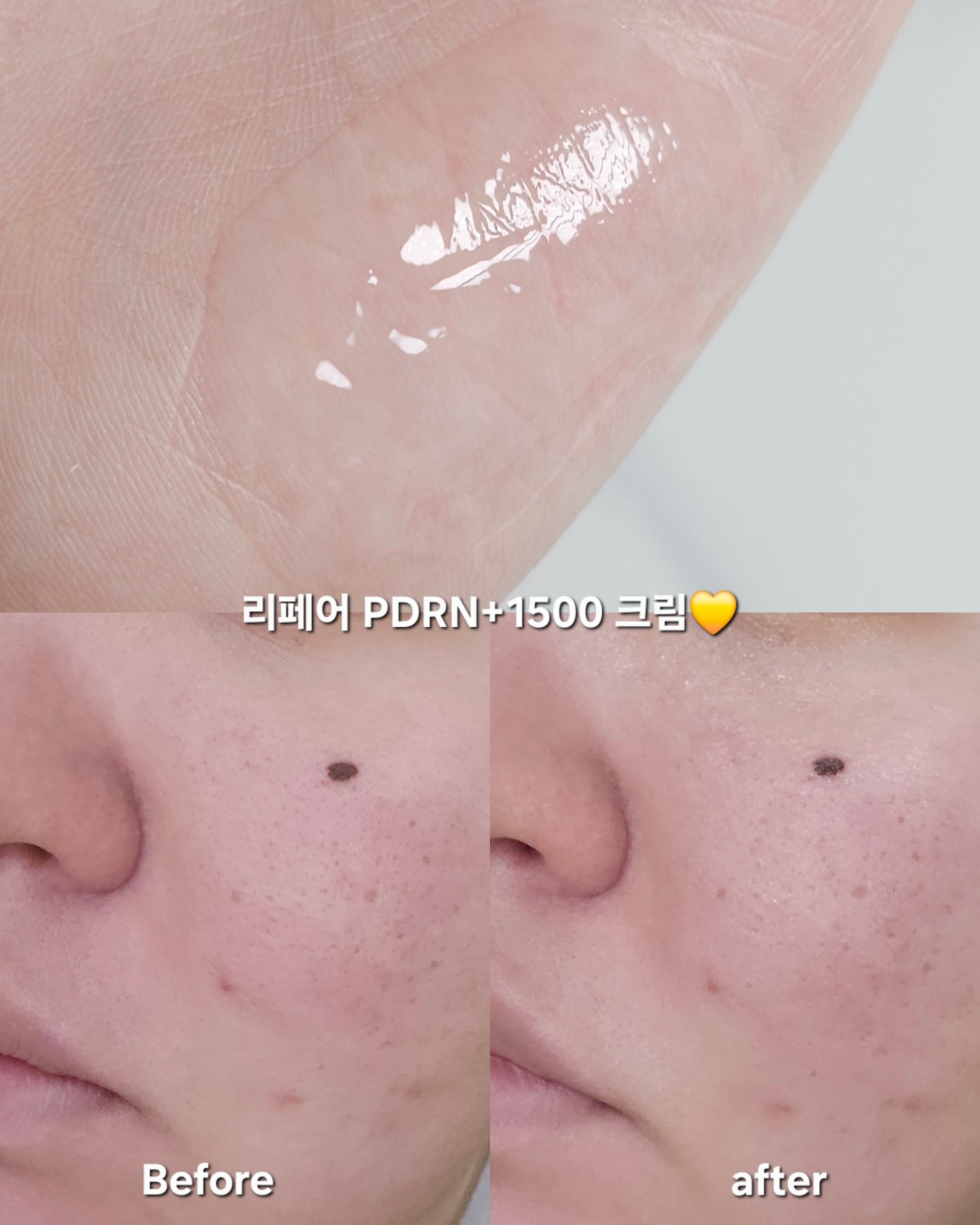 리페어 PDRNTX+ 1500 크림 이미지 2