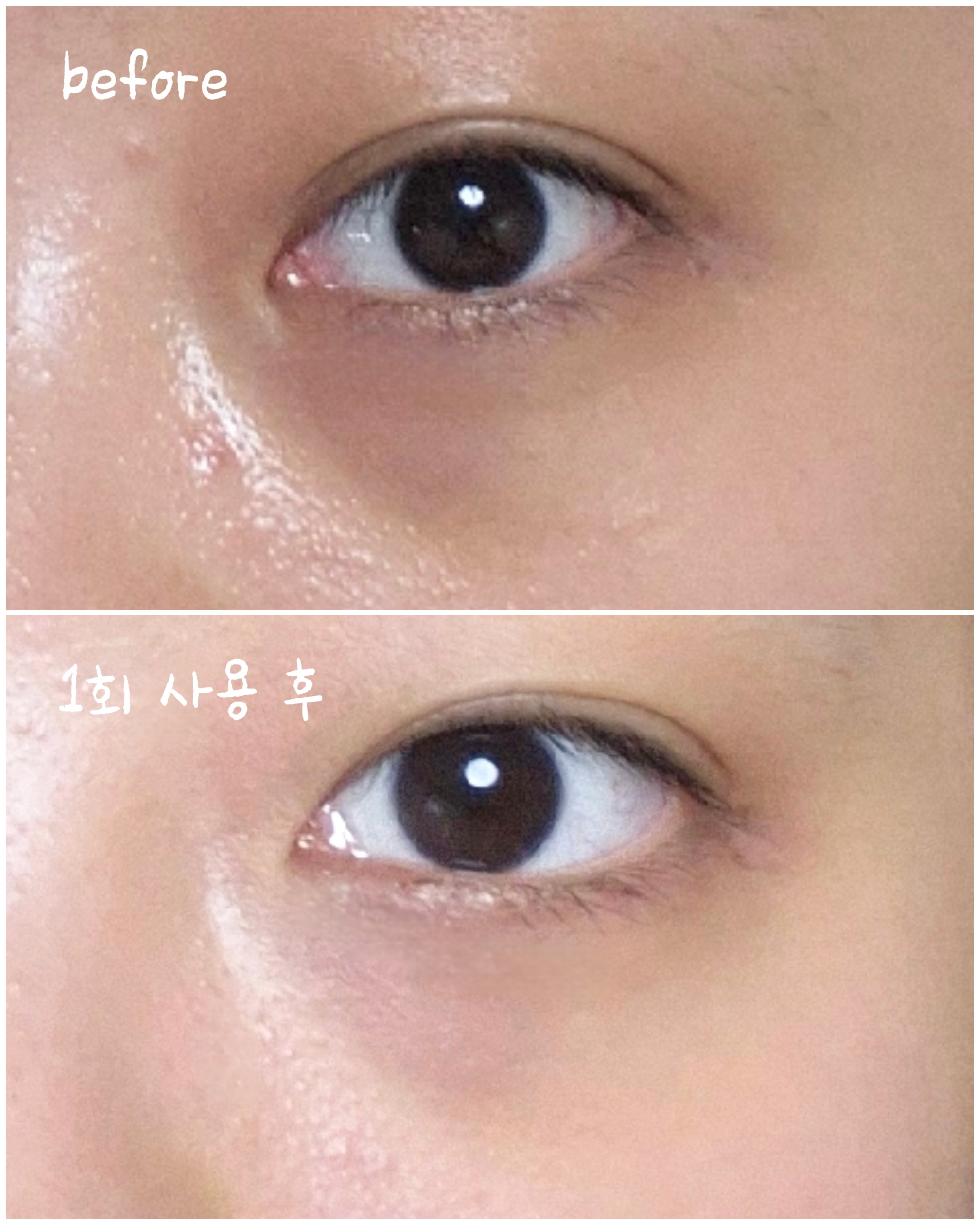 아이백 브라이트닝 2200샷 패치 이미지 1
