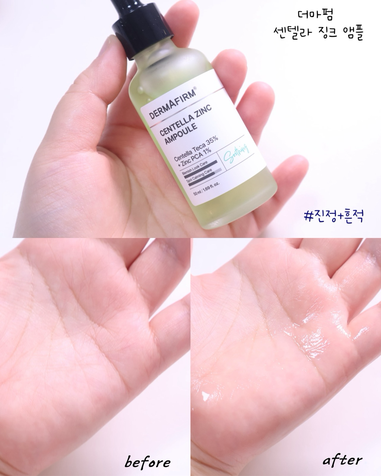 센텔라 징크 앰플 이미지 1